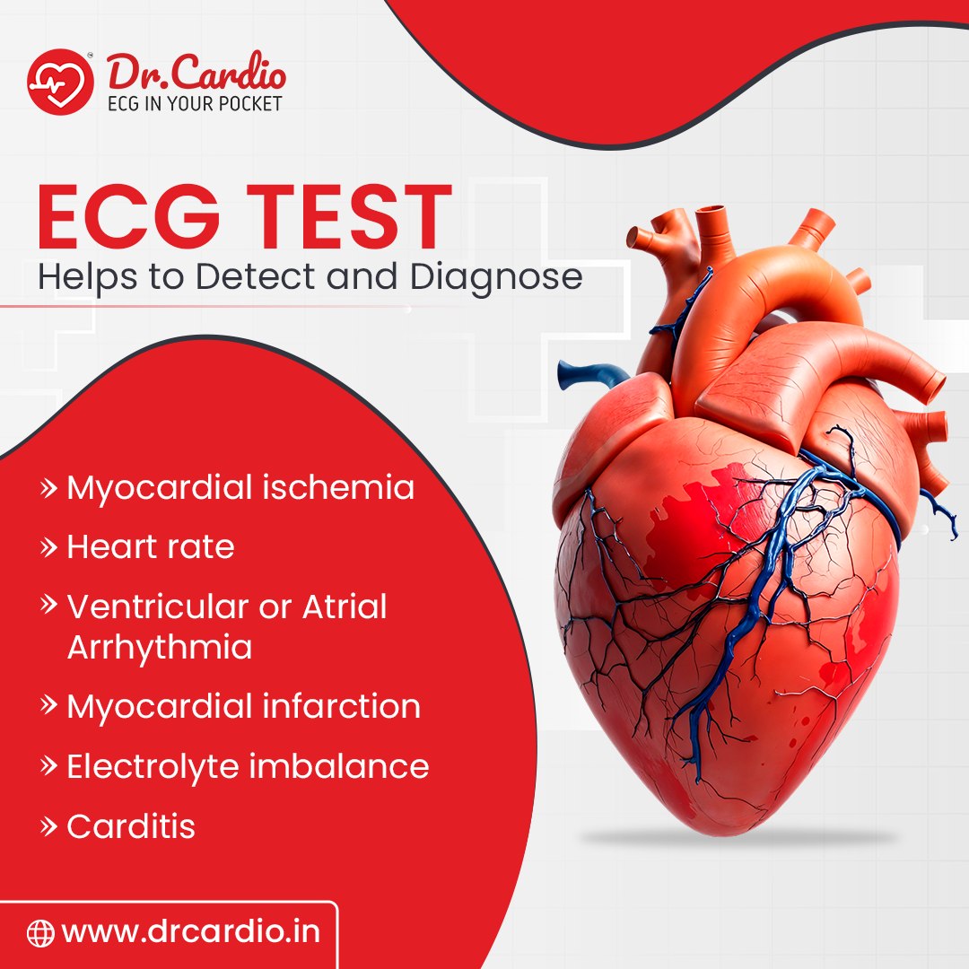 ECG Test Helps to Detect and Diagnose